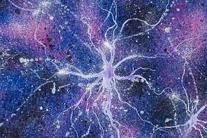 difabio_neuroni_ante